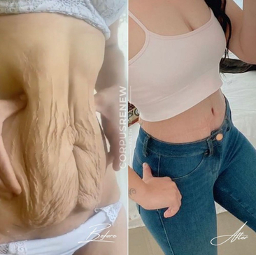 Slider image (7) CorpusRenew by Termessos Hospital